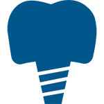Implante Dentário